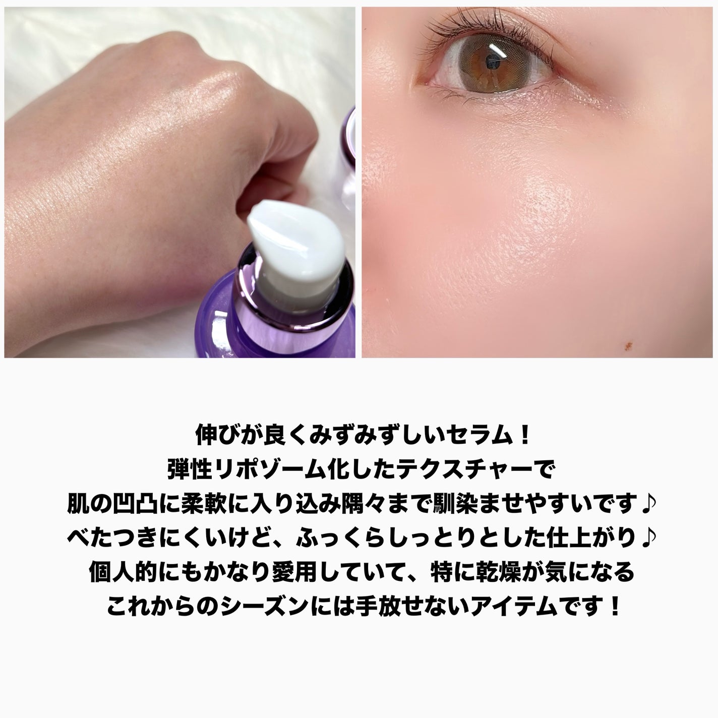 プロバイオダーム™ コラーゲンリモデリングセラム/BIOHEAL BOH/美容液を使ったクチコミ(6枚目)