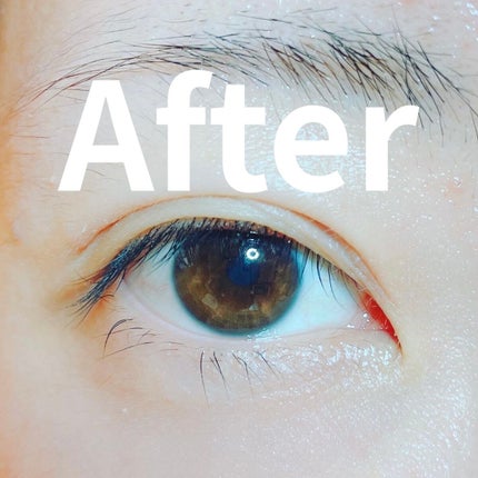 TWOOLダブルアイリッドハイブリットフィルム/SHOBIDO/二重まぶた用アイテムを使ったクチコミ(5枚目)