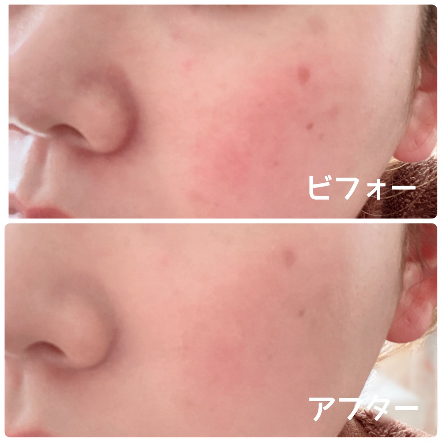 SIGNATURE ESSENCE COVER PACT /AGE20’s/クリーム・エマルジョンファンデーションを使ったクチコミ(5枚目)