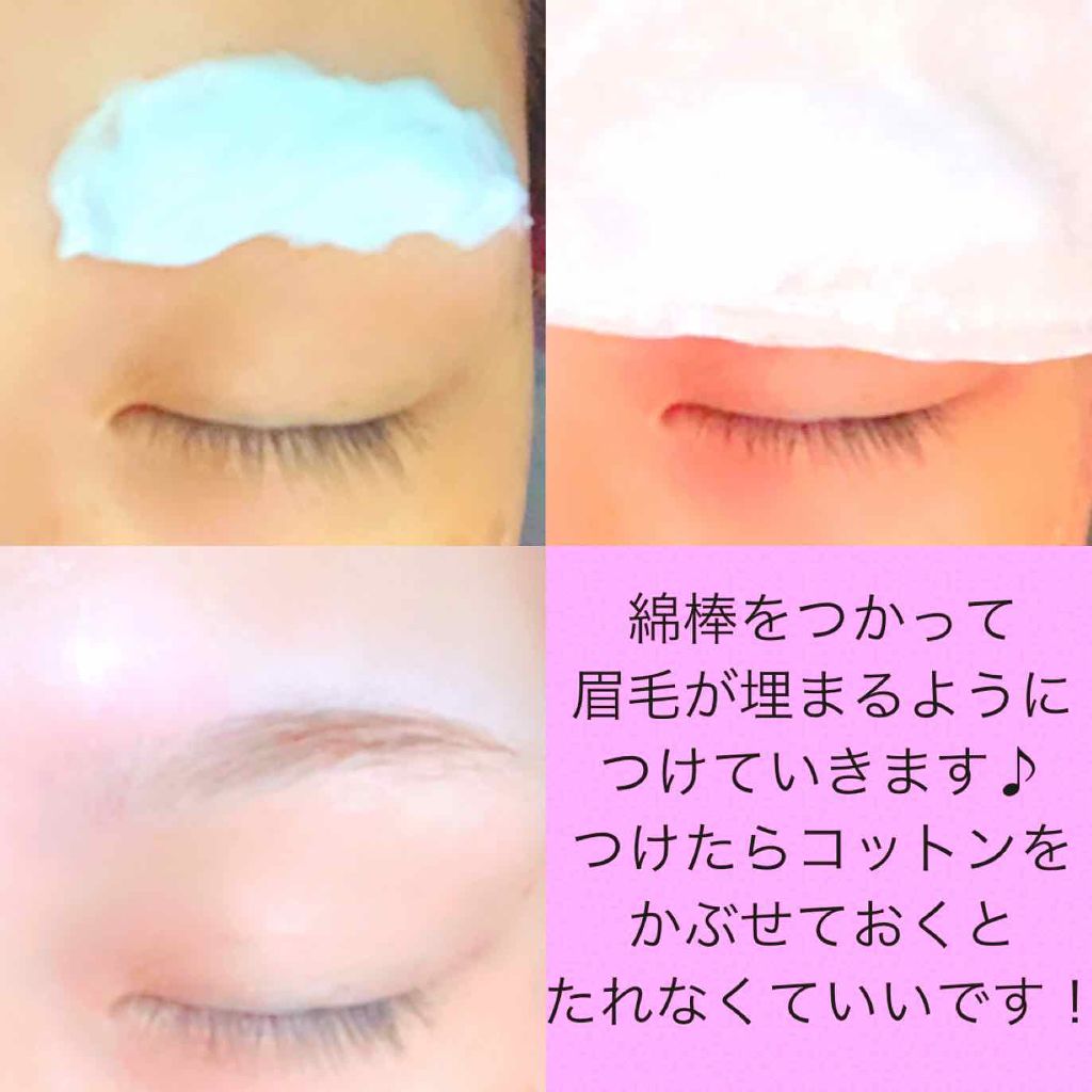 脱色クリーム スピーディー/エピラット/ムダ毛ケアを使ったクチコミ（3枚目）