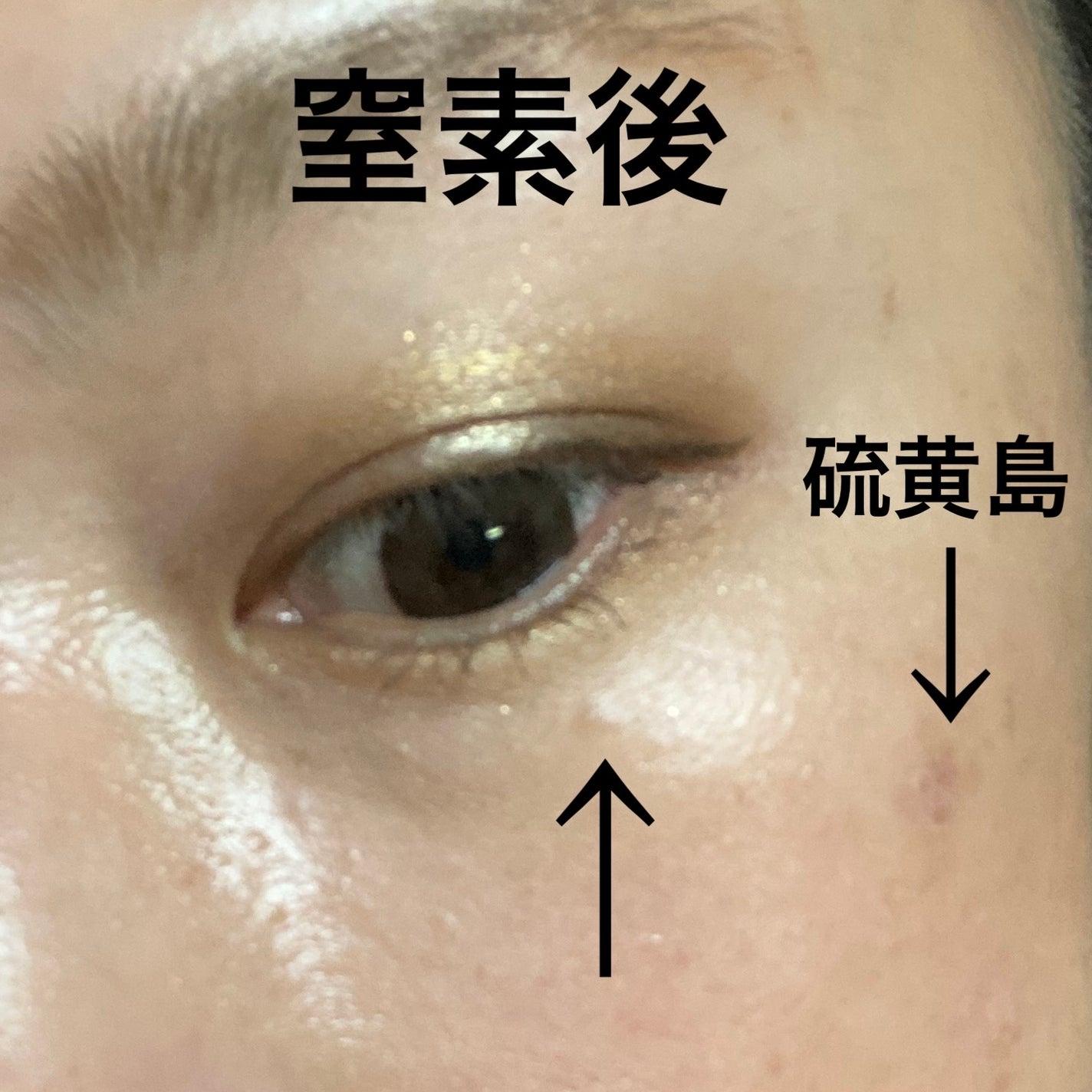 ためしたがり43歳 on LIPS 「どうも、本日も無加工でババアのイボをお届け。蛍光灯下の現実を直..」(1枚目)