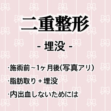 二重整形 埋没 ⚠️実際の目の写真あり

初投稿⭐︎

1回目の埋没+まぶたの脂肪取りレポです！

両目ともまぶたが腫れぼったい一重で凄く目つきが悪くて、二重に憧れて4年間アイプチ、アイテープ、メザイク