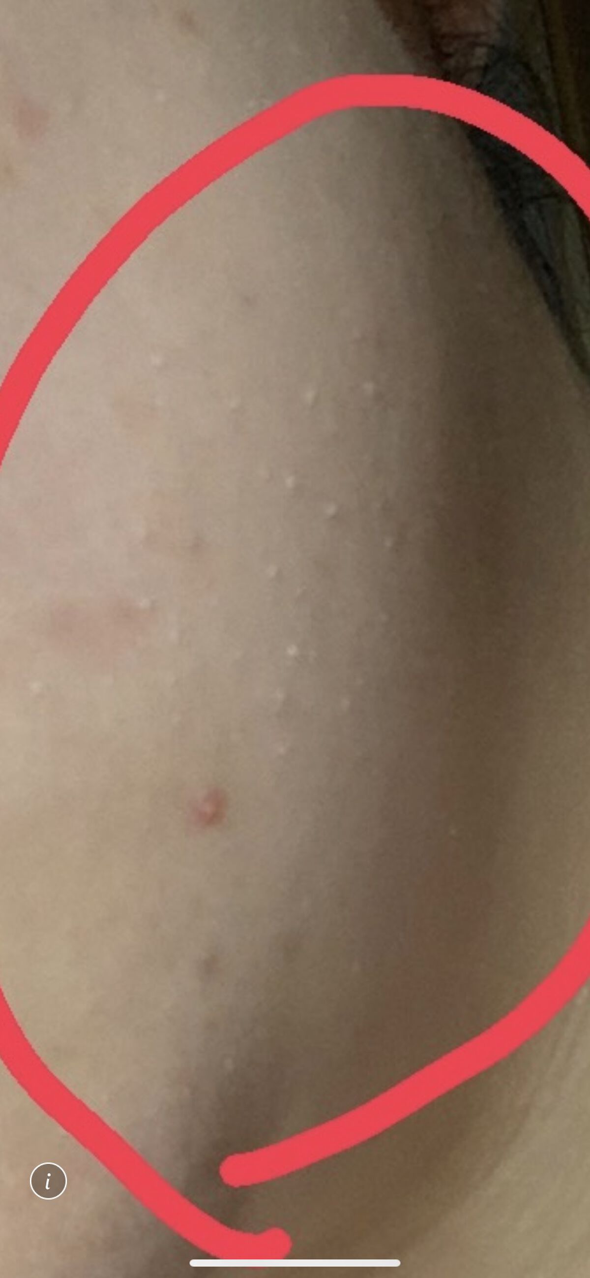 DETクリア ブライト＆ピール ピーリングジェリー＜無香料タイプ＞/Detclear/ピーリングを使ったクチコミ（1枚目）