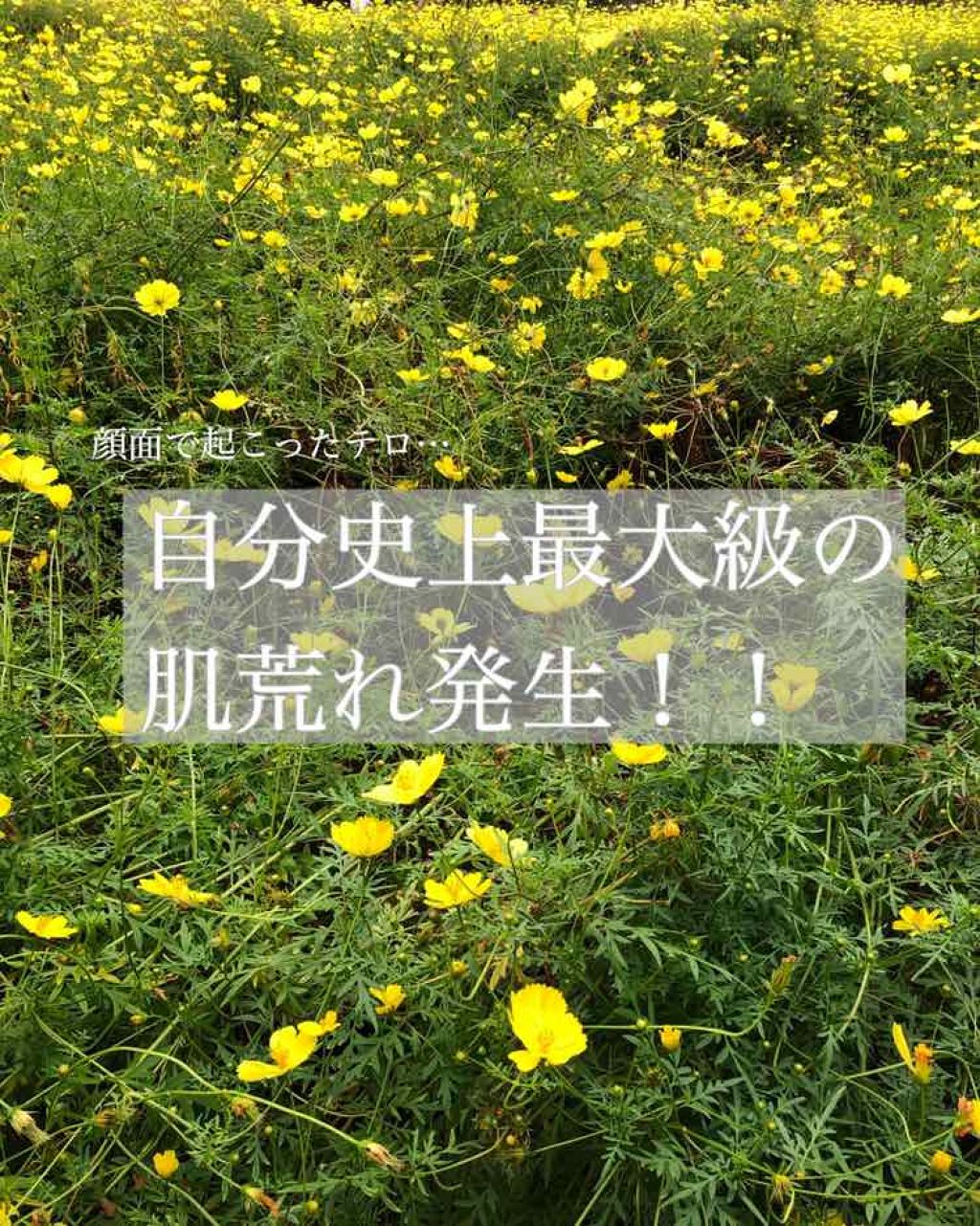 セラミドスキンケア 薬用アクネVCローション/エトヴォス/化粧水を使ったクチコミ（1枚目）