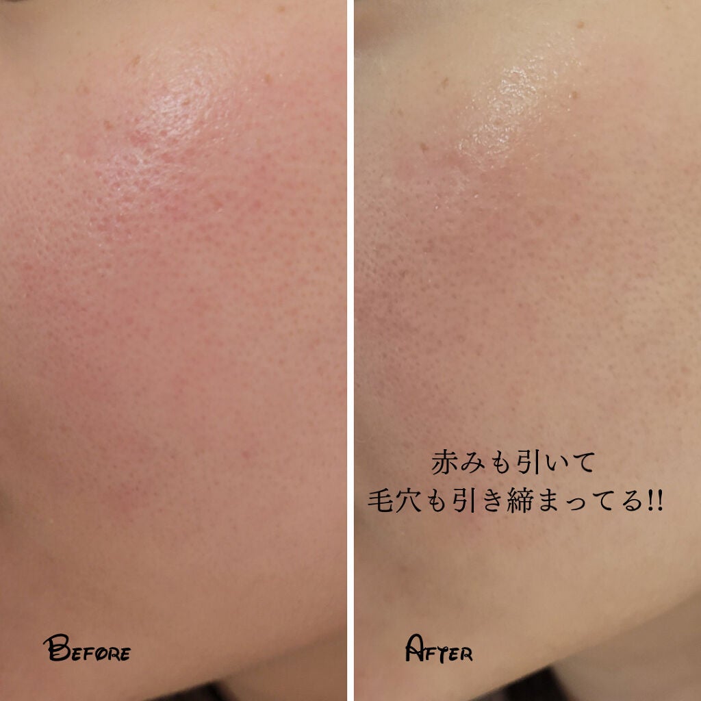 ドクダミ 77 スージングトナー/Anua/化粧水を使ったクチコミ(5枚目)