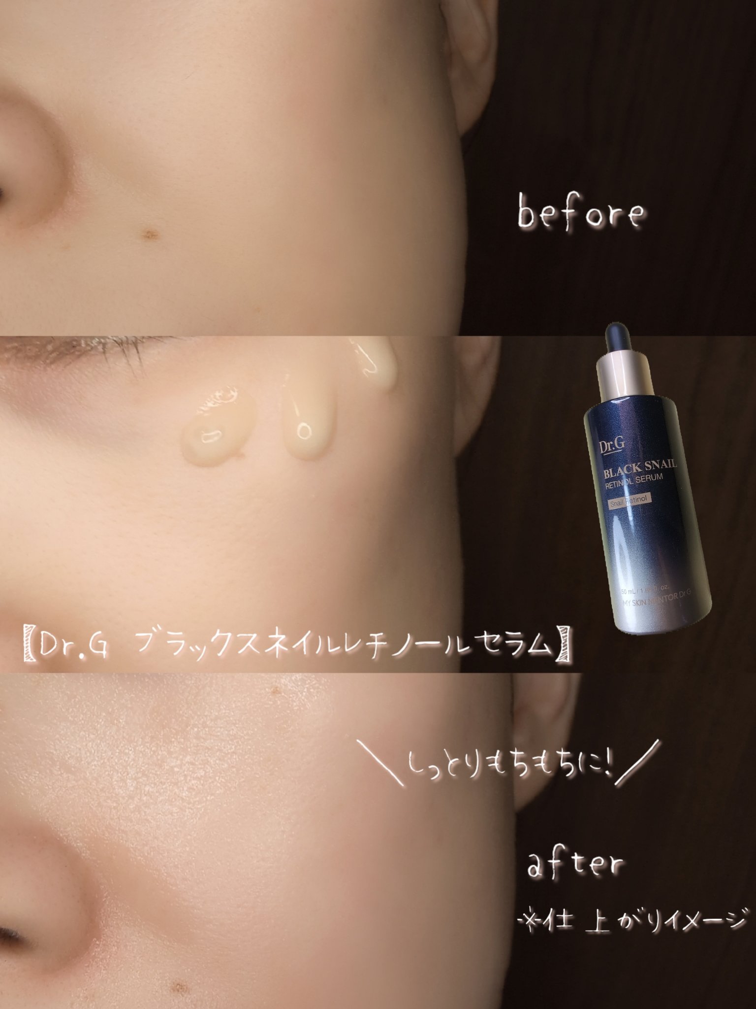 ブラックスネイルレチノールセラム/Dr.G/美容液を使ったクチコミ（2枚目）