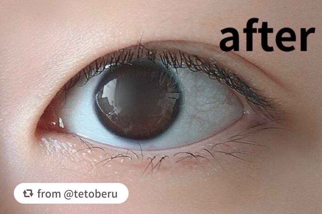 ハイブリッドフィルム スーパーマット/アイトーク/二重まぶた用アイテムを使ったクチコミ(4枚目)