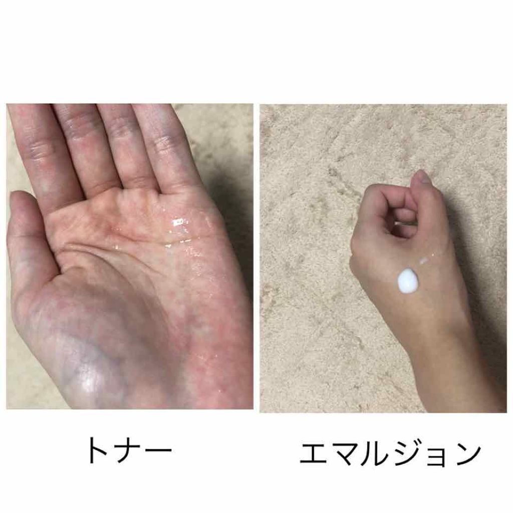 スンジョン トナー/ETUDE/化粧水を使ったクチコミ(3枚目)