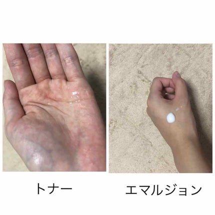 スンジョン トナー/ETUDE/化粧水を使ったクチコミ(3枚目)