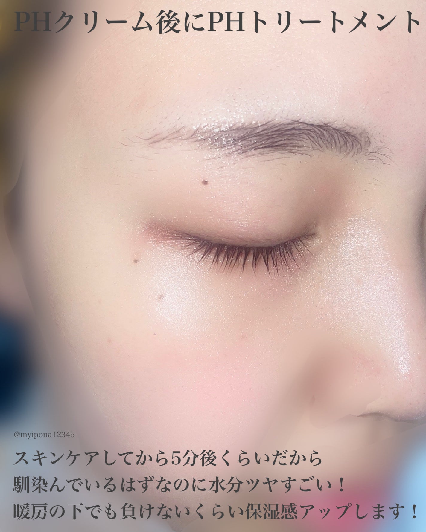 サミュ PHセンシティブフェイシャルトリートメント/SAM'U/美容液を使ったクチコミ(5枚目)