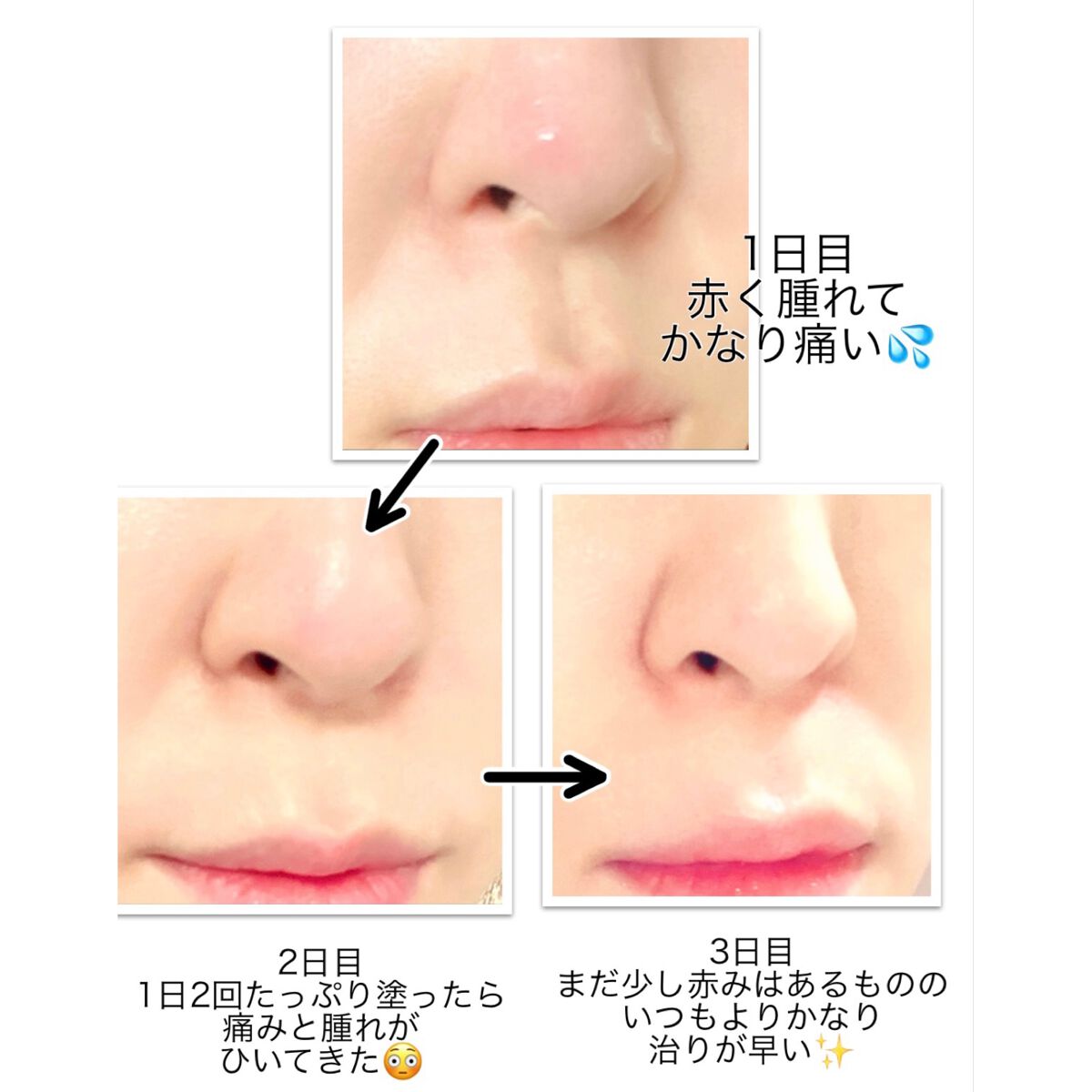 マジックティーツリーオイル/ブラン/フェイスオイルを使ったクチコミ(2枚目)