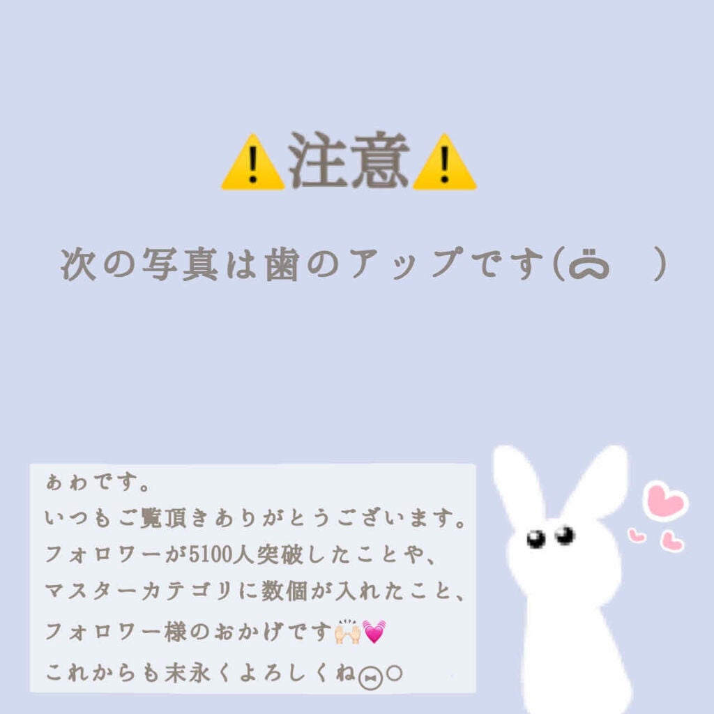 ソニッケアー ダイヤモンドクリーンスマート/フィリップス/電動歯ブラシを使ったクチコミ(2枚目)