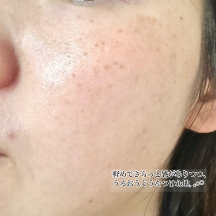 ジェニフィック アルティメ セラム/LANCOME/美容液を使ったクチコミ(5枚目)