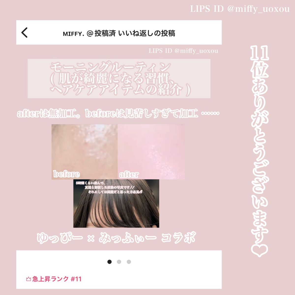 ジェルコートF/ウエルテック/その他オーラルケアを使ったクチコミ(4枚目)