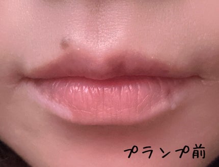ボリュームリッププランパー/BANILA CO/リッププランパーを使ったクチコミ(5枚目)