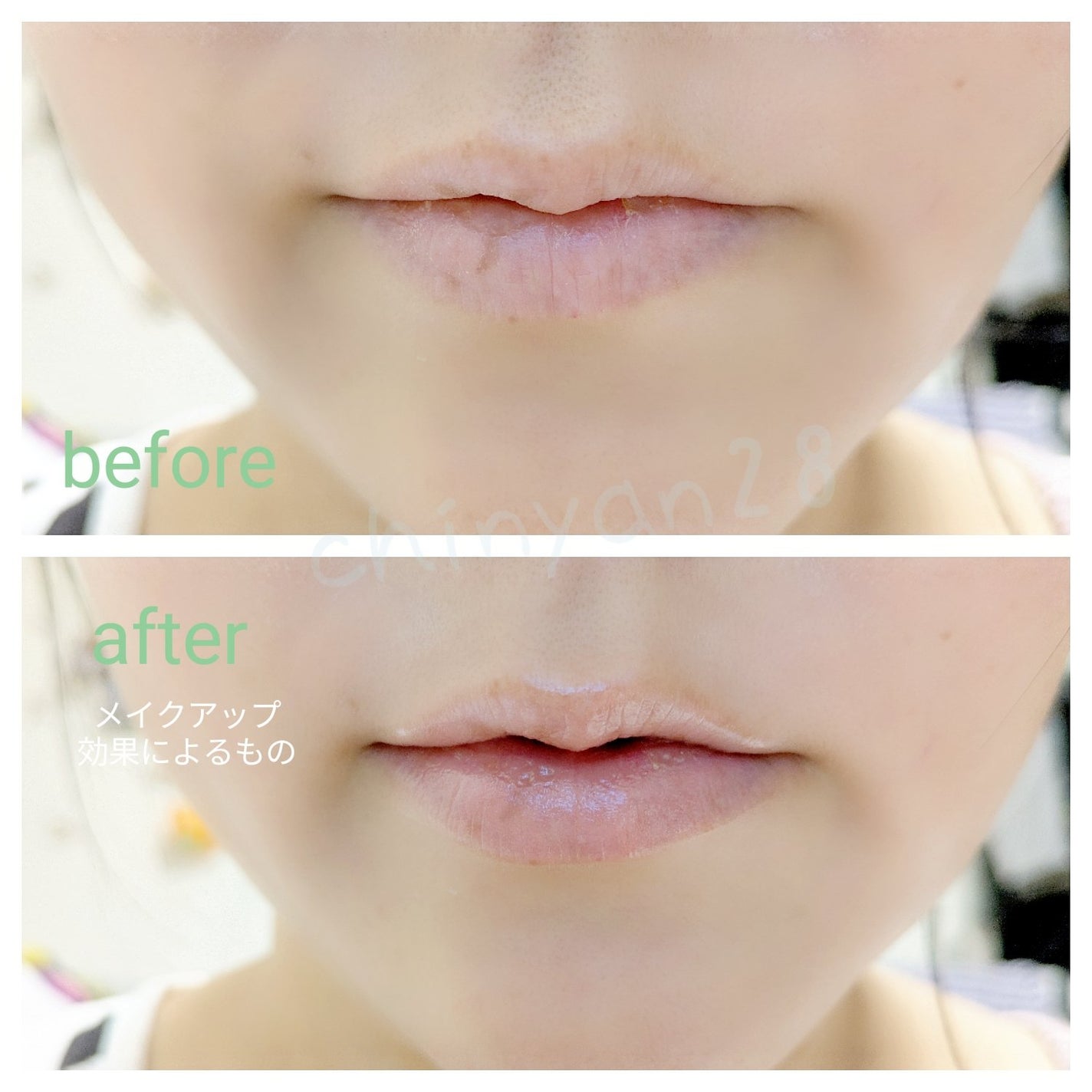 ダーマパワーX リップエッセンス/オバジ/リップ美容液を使ったクチコミ(4枚目)