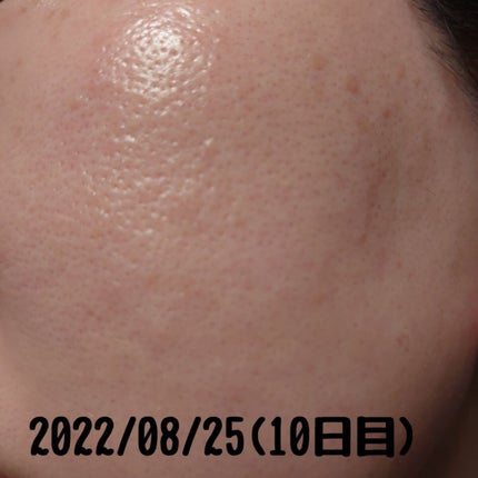 レチノールA 1% アドバンスドリバイタリゼーションクリーム/Life-flo/フェイスクリームを使ったクチコミ(5枚目)