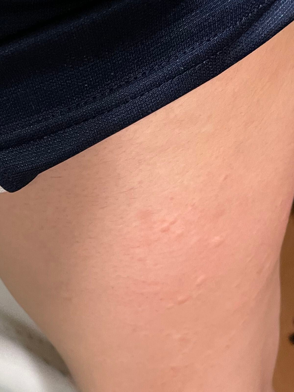 PローションCA/ピコモンテ/化粧水を使ったクチコミ(3枚目)