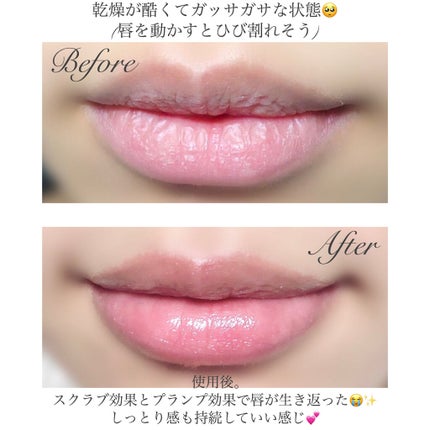 プランプリップケアスクラブ/キャンメイク/リップスクラブを使ったクチコミ(5枚目)