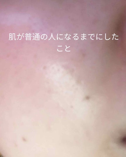 アエナ どろもっち/AENA(アエナ)/その他洗顔料を使ったクチコミ(1枚目)