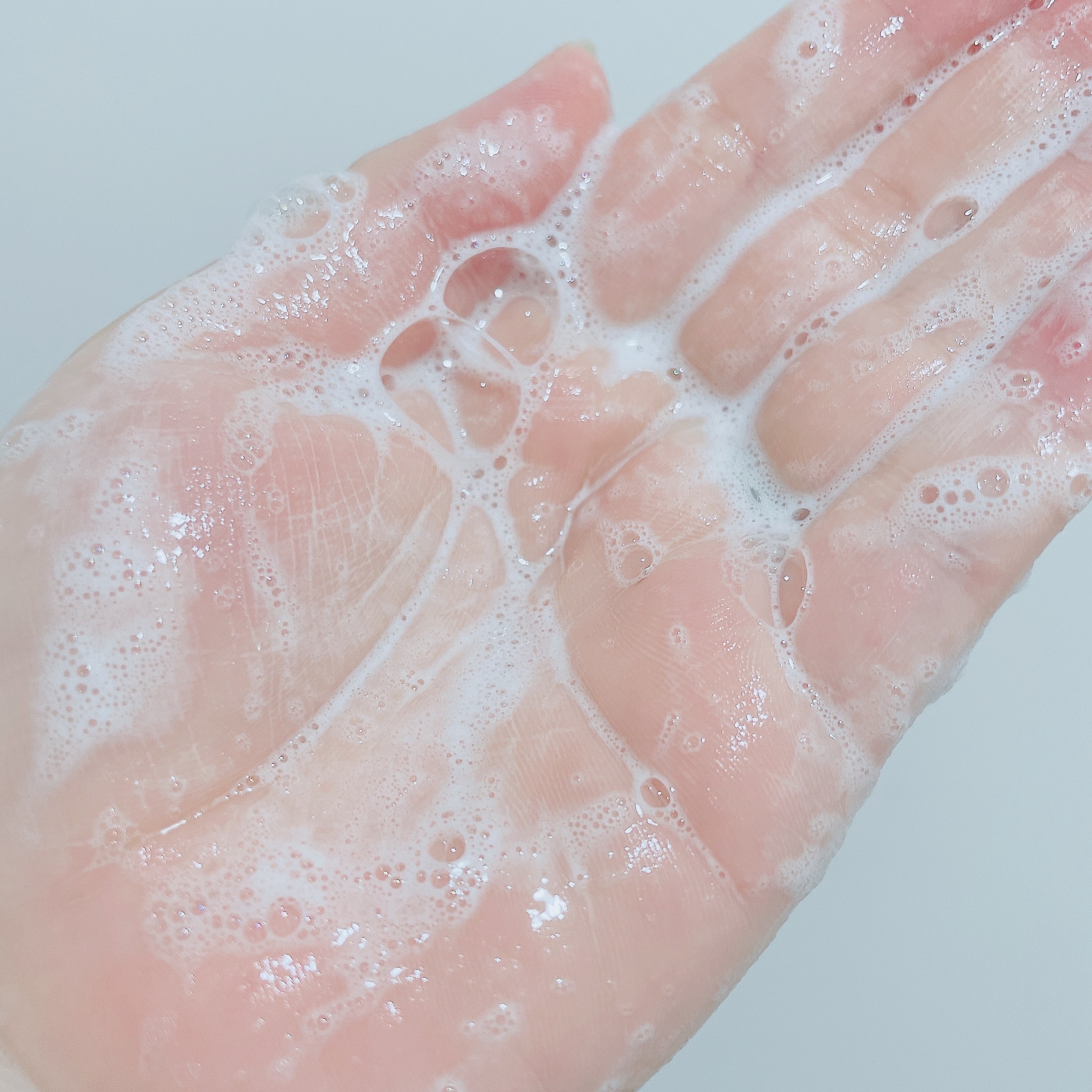 アデノバイタル  シャンプー/サブリミック/サロンシャンプーを使ったクチコミ（3枚目）