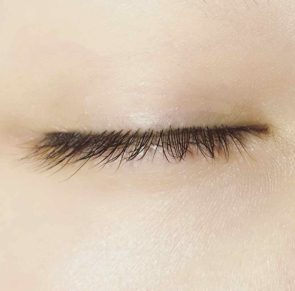 肌色タイプ/バンドエイド/その他を使ったクチコミ（2枚目）