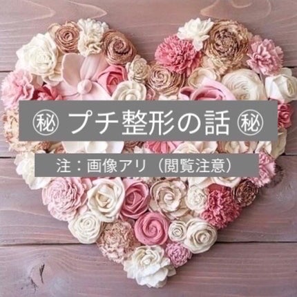 二重整形/その他を使ったクチコミ(1枚目)