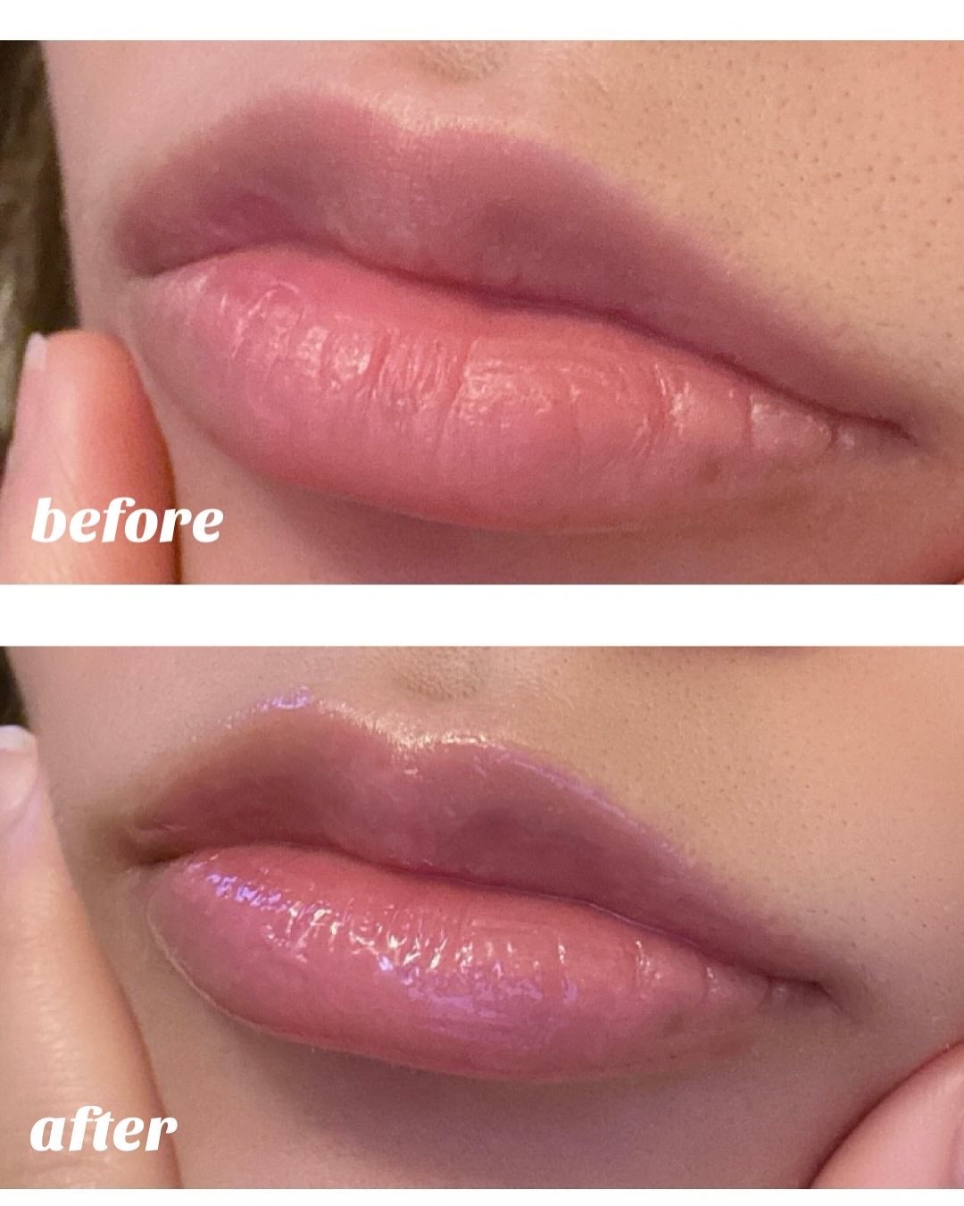 プリティーフィルターデイライトリッププランピングマスク/touch in SOL /リップマスクを使ったクチコミ(4枚目)