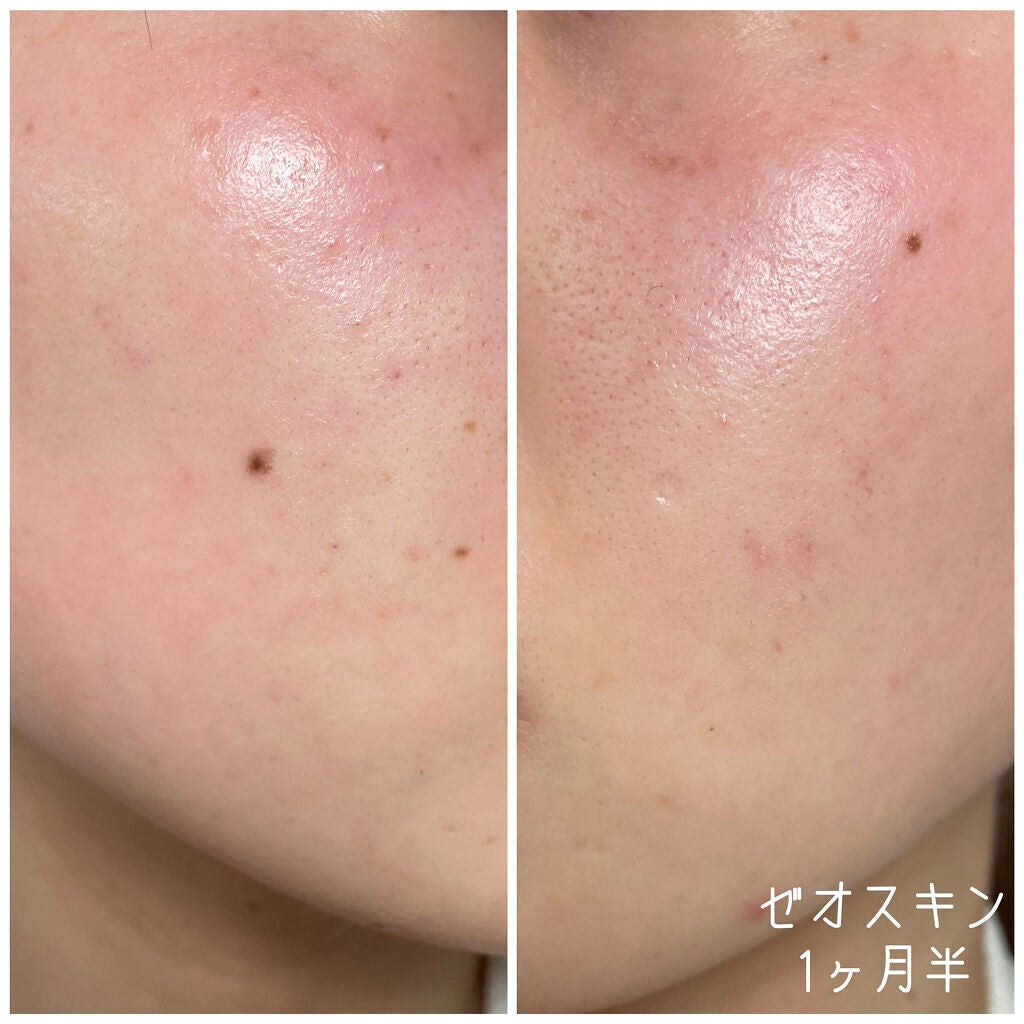 ミラミン/ZO Skin Health/フェイスクリームを使ったクチコミ(6枚目)