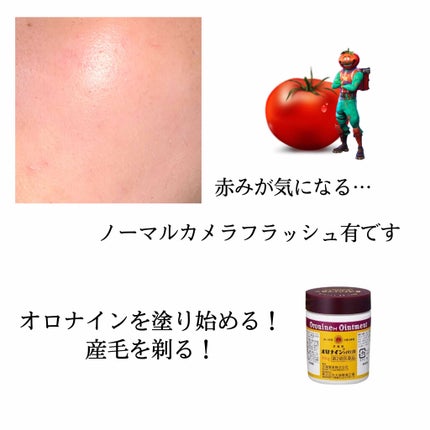オロナインH軟膏 (医薬品)/オロナイン/その他を使ったクチコミ(3枚目)