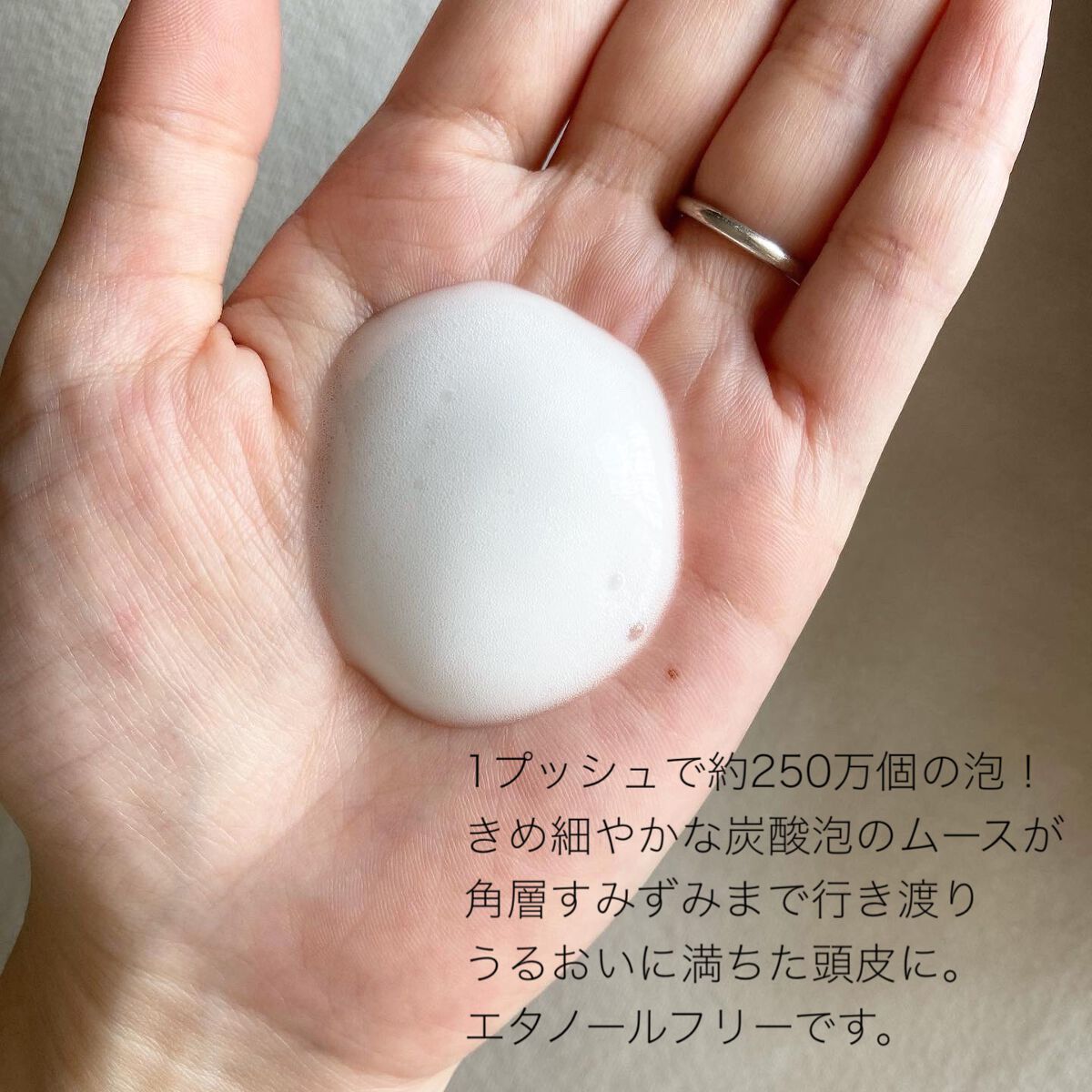 アクア チャージ ムース/ines/頭皮ローションを使ったクチコミ（2枚目）