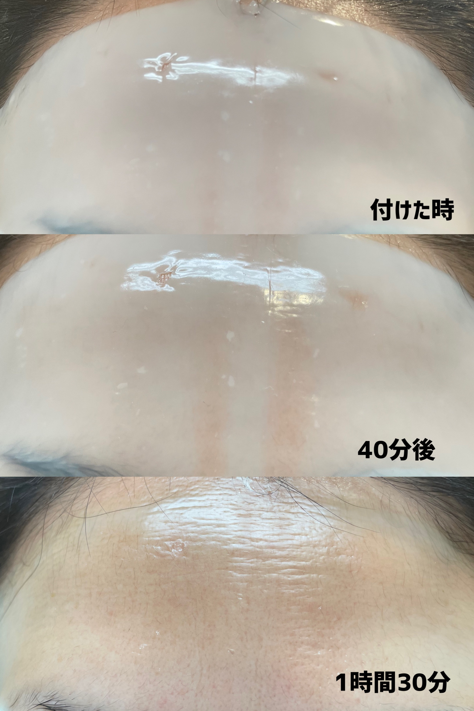 プレミアムシカトリートメントフィッティングマスクパック/WellDerma/シートマスク・パックを使ったクチコミ（3枚目）