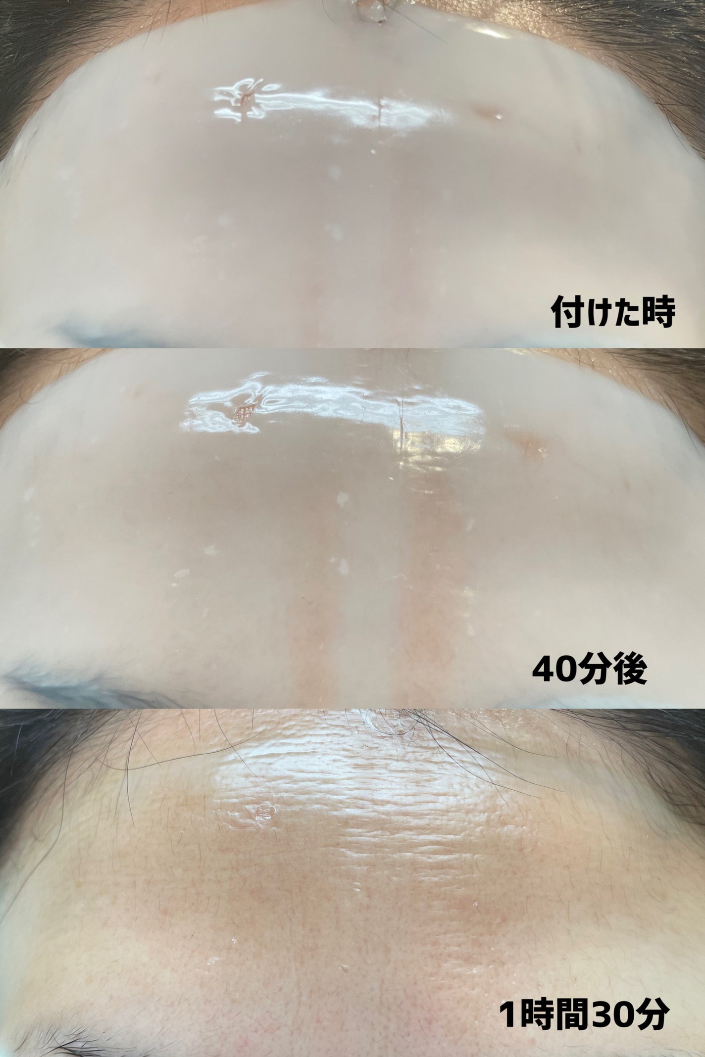 プレミアムシカトリートメントフィッティングマスクパック/WellDerma/シートマスク・パックを使ったクチコミ(3枚目)