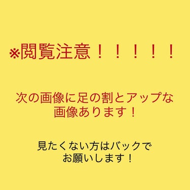 マイルド＆モイスチャーアロエジェル/ネイチャーリパブリック/ボディローションを使ったクチコミ（2枚目）