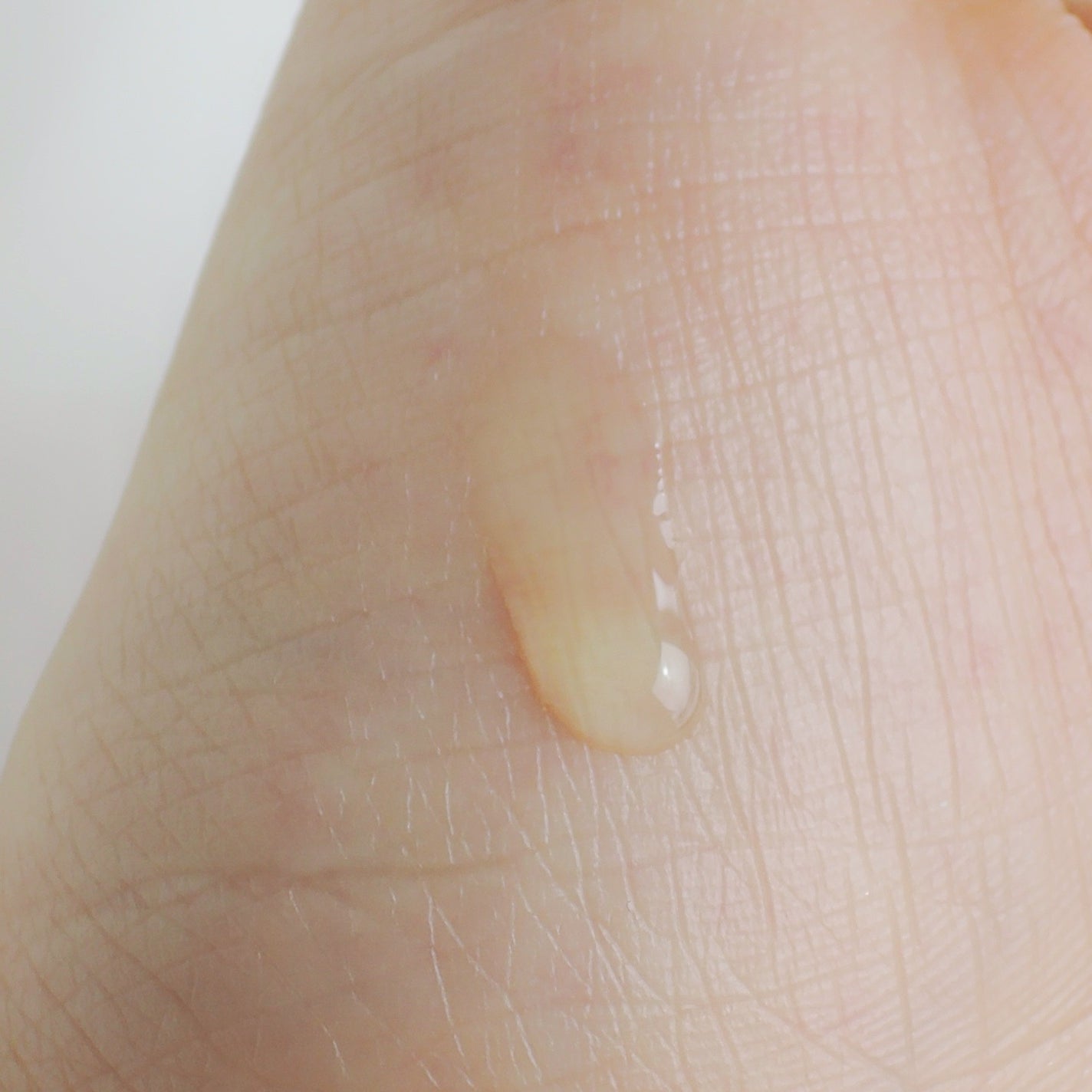 サイエンシューティカルズアンプル /PHYSIOGEL/美容液を使ったクチコミ(3枚目)