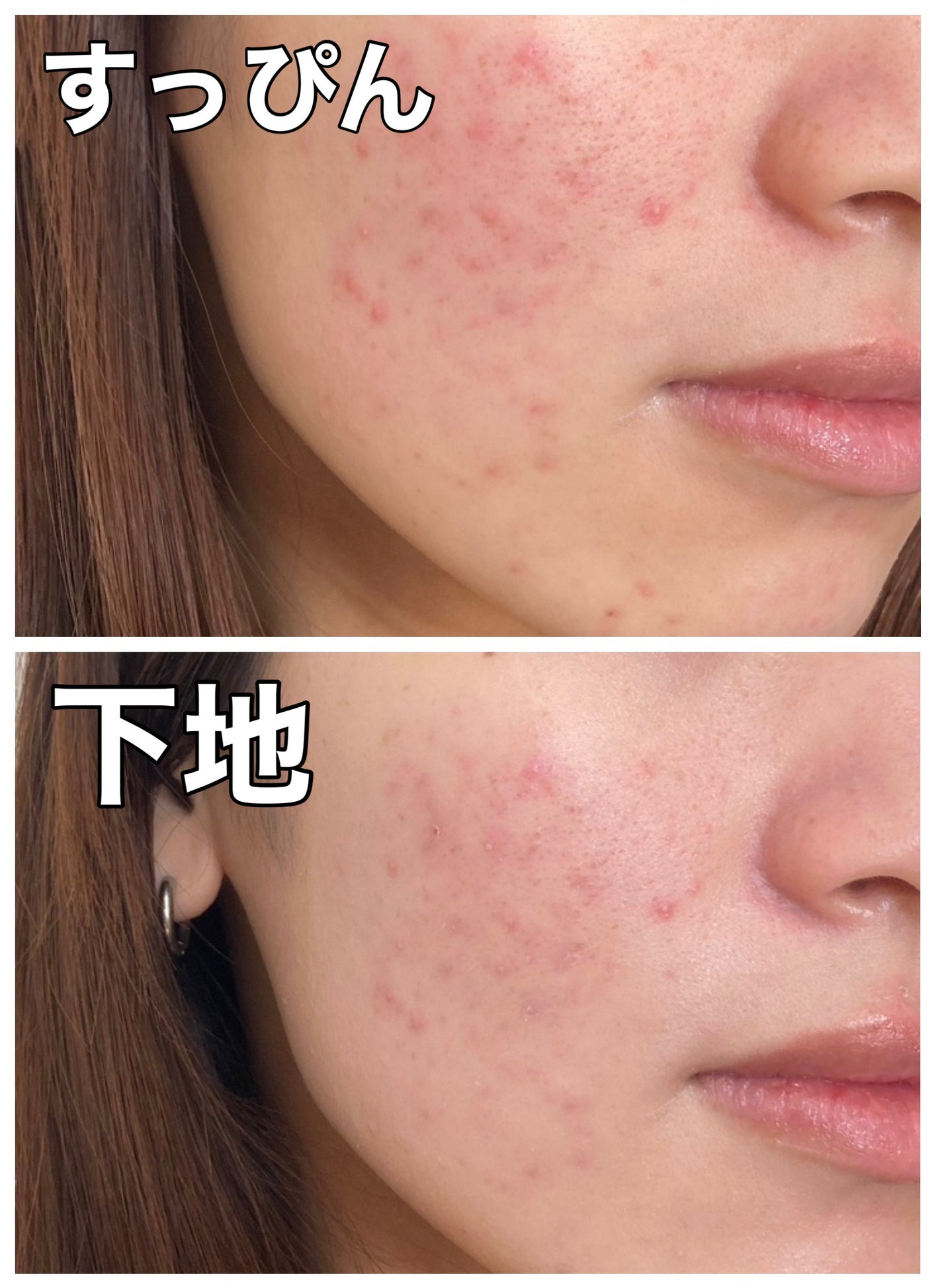 UVã€ã㢠XL ãããã¯ã·ã§ã³ããŒã³ã¢ãã ããŒãº+/ã© ããã·ã¥ ããŒ/æ¥çŒãæ¢ãã»UVã±ã¢ã䜿ã£ãã¯ãã³ãïŒ2æç®ïŒ