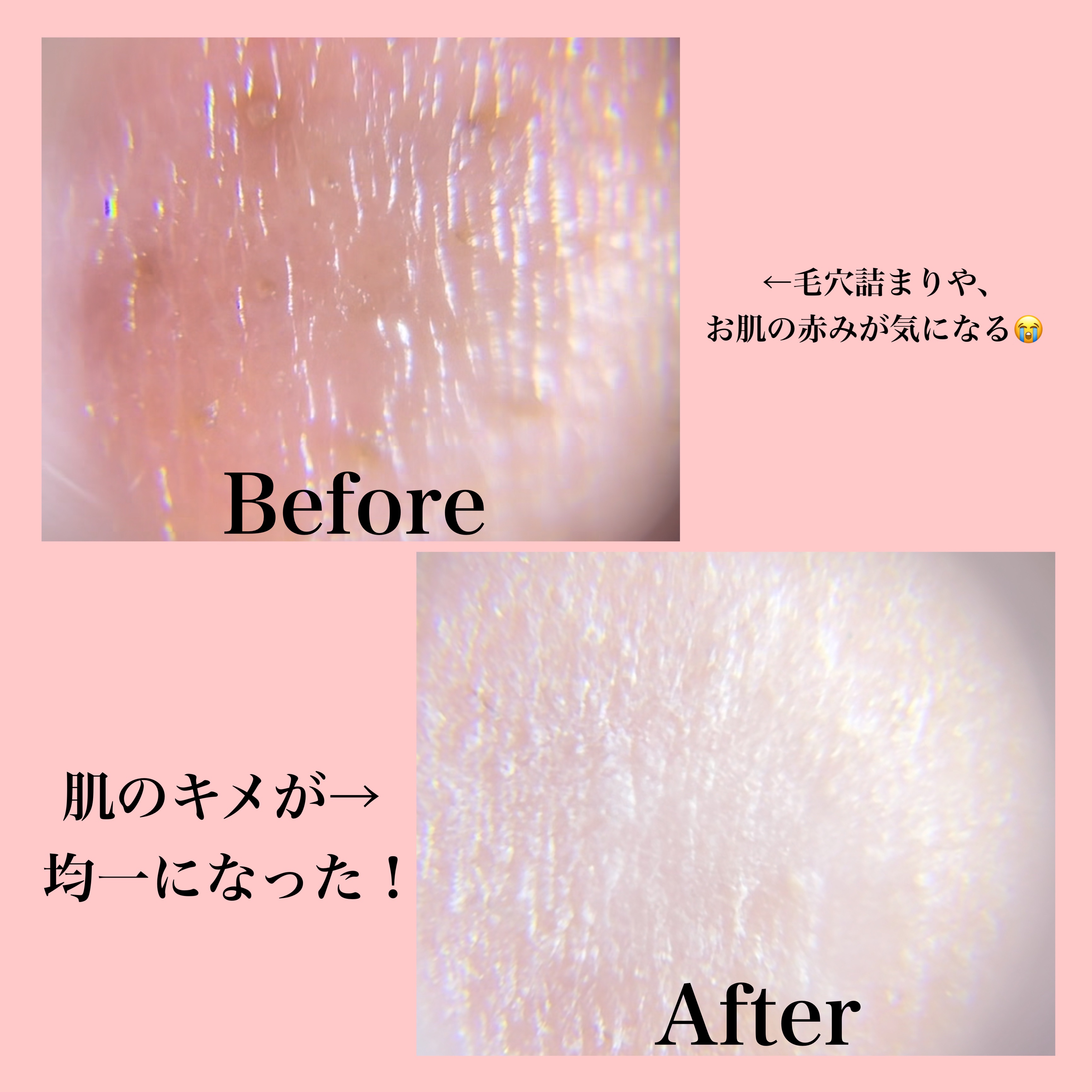 リードルショット700/VT/美容液を使ったクチコミ（3枚目）