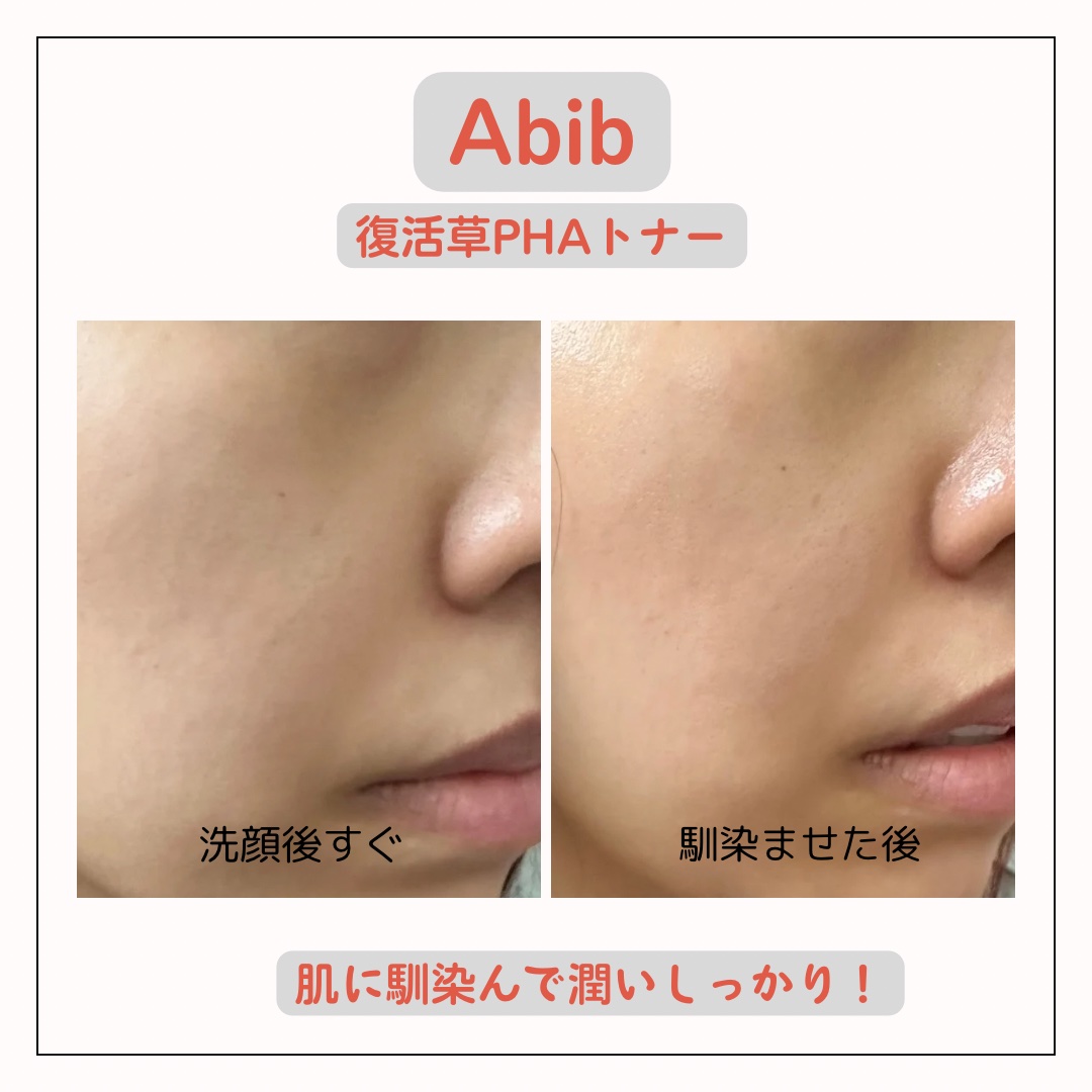 復活草PHAトナー スキンブースター/Abib /化粧水を使ったクチコミ（2枚目）