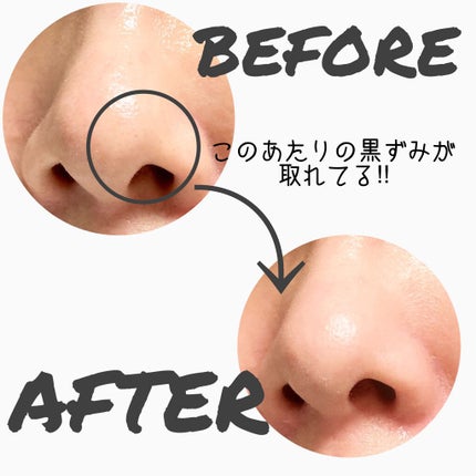 ブラック ヘッド ゼロ 2ステップ ノーズ パッチ/Dr.Althea/シートマスク・パックを使ったクチコミ(5枚目)