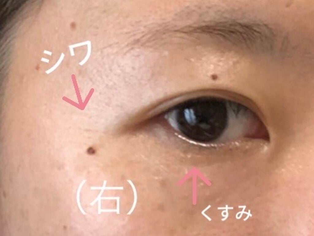 アイキララII/北の快適工房/アイケア・アイクリームを使ったクチコミ(3枚目)