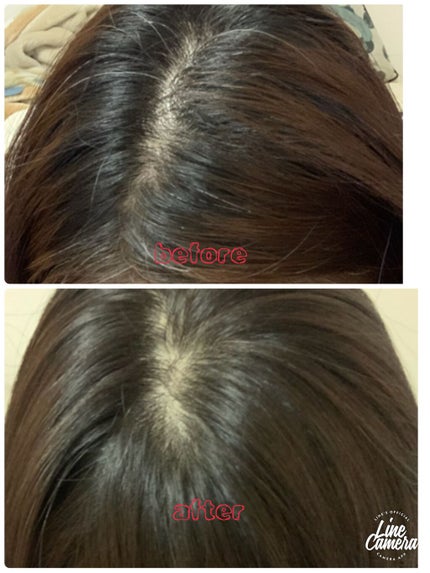 泡カラー 白髪用/ブローネ/ヘアカラーを使ったクチコミ(3枚目)