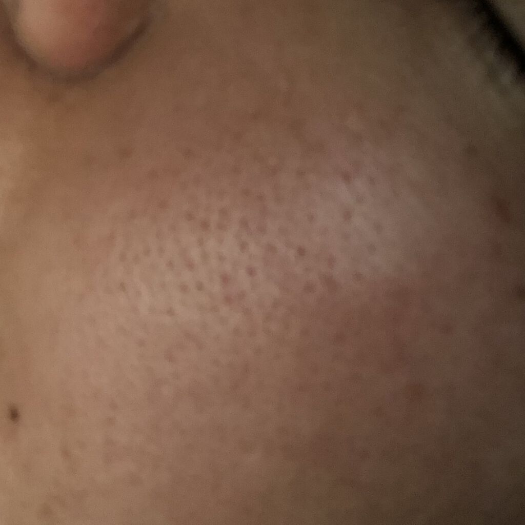 CICA マイルドトナーパッド/VT/トナーパッドを使ったクチコミ（2枚目）