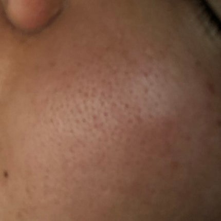 CICA マイルドトナーパッド/VT/トナーパッドを使ったクチコミ(2枚目)