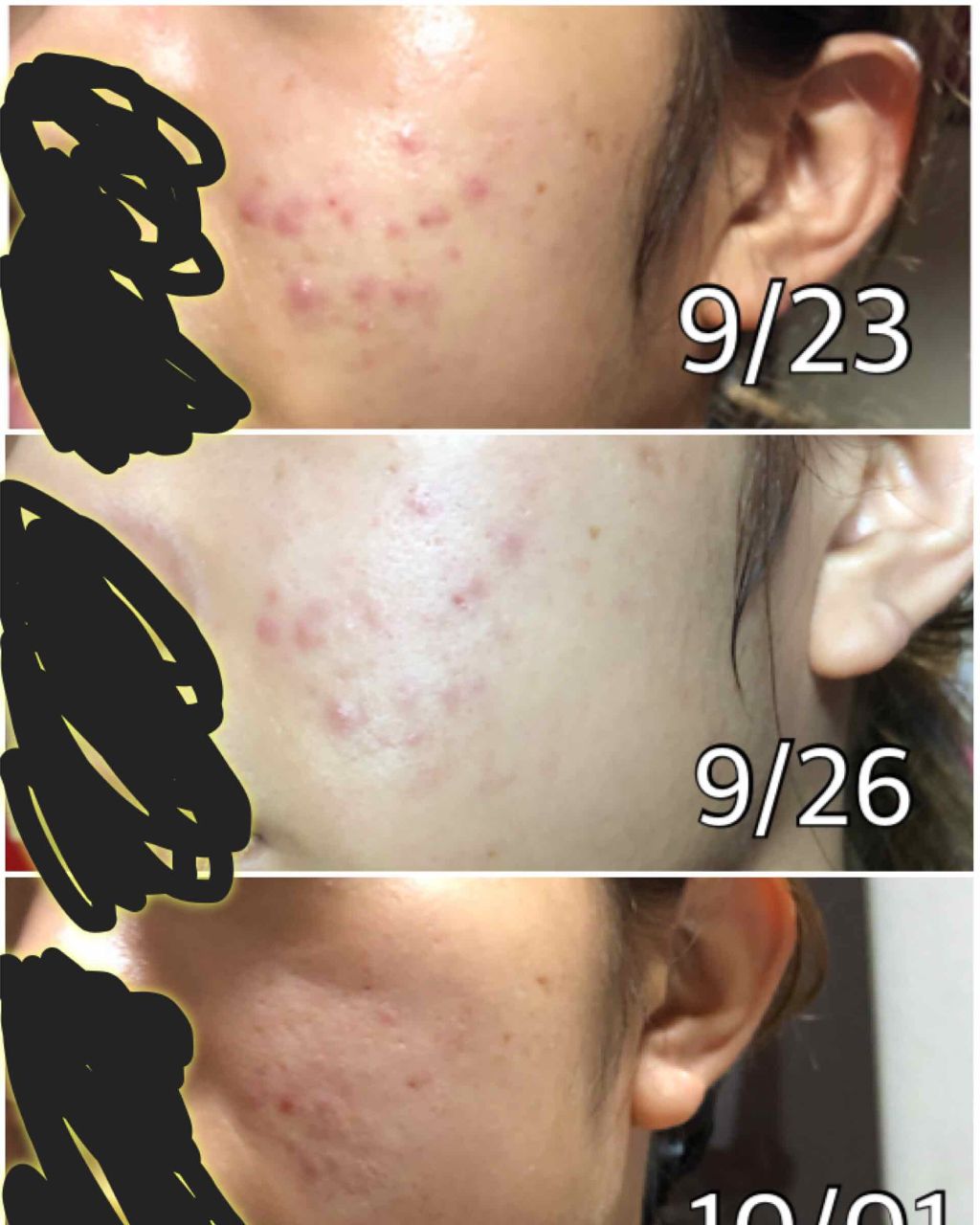 菊正宗 日本酒の化粧水 高保湿/菊正宗/化粧水を使ったクチコミ（2枚目）