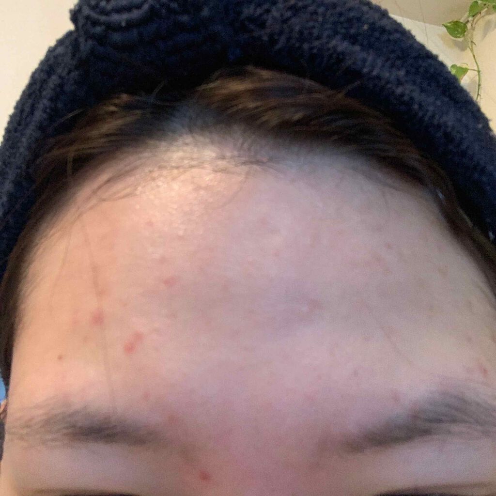 デュオ ザ クレンジングバーム/DUO/クレンジングバームを使ったクチコミ（2枚目）