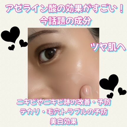 A.Cクリーム プレミアム/LEPOREM/フェイスクリームを使ったクチコミ(3枚目)