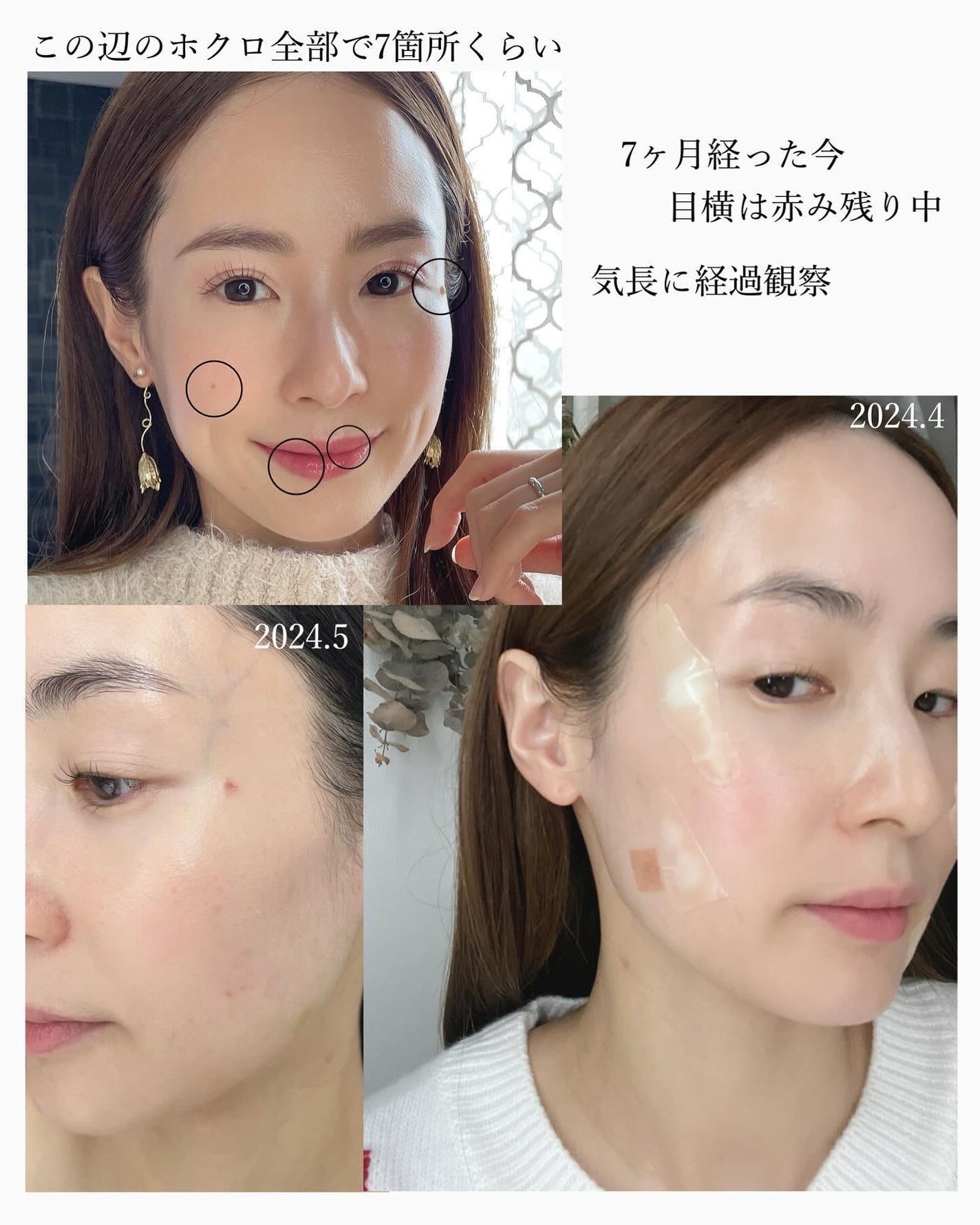 mayuðª·ãã©ããâ© on LIPS ãæ¥ã
ã®ã±ã¢ãšç¿æ
£ã§-9æ³èãå¶ããå
ïŸïŸïŸã®ææ°çŸå®¹æ
å ±ð@..ãïŒ2æç®ïŒ