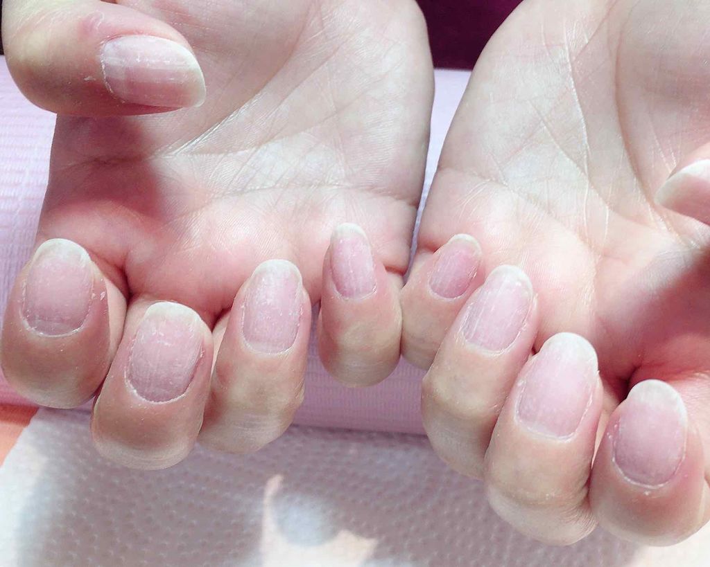 ネイルエンビー/O・P・I/ネイルオイル・トリートメントを使ったクチコミ(2枚目)