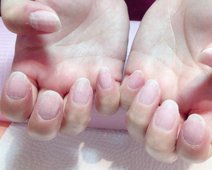 ネイルエンビー/O・P・I/ネイルオイル・トリートメントを使ったクチコミ(2枚目)