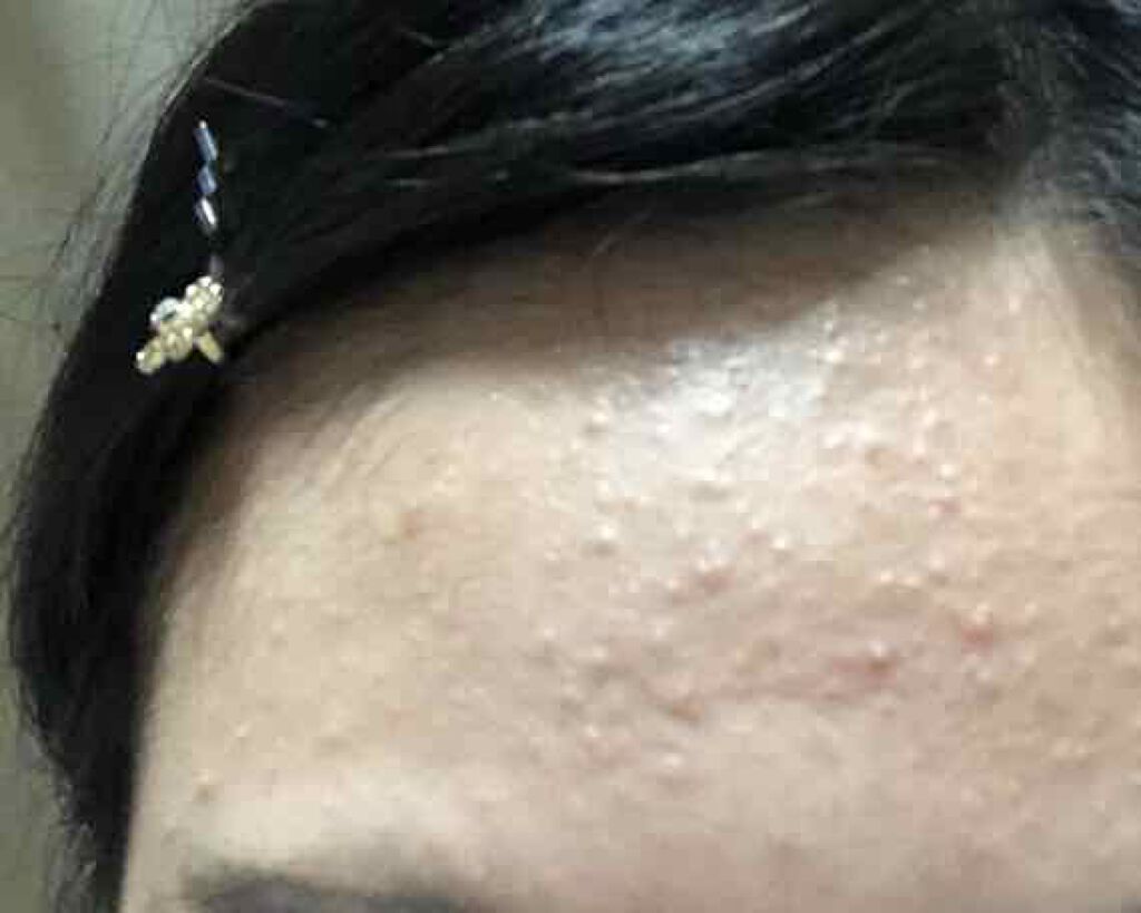 onigirið on LIPS ããã«ããã§ãïŒä»åã¯ç§ã®ãã£ãšæ¹åããªãã£ãã«ãã³ãããã¡ã®ã..ãïŒ2æç®ïŒ